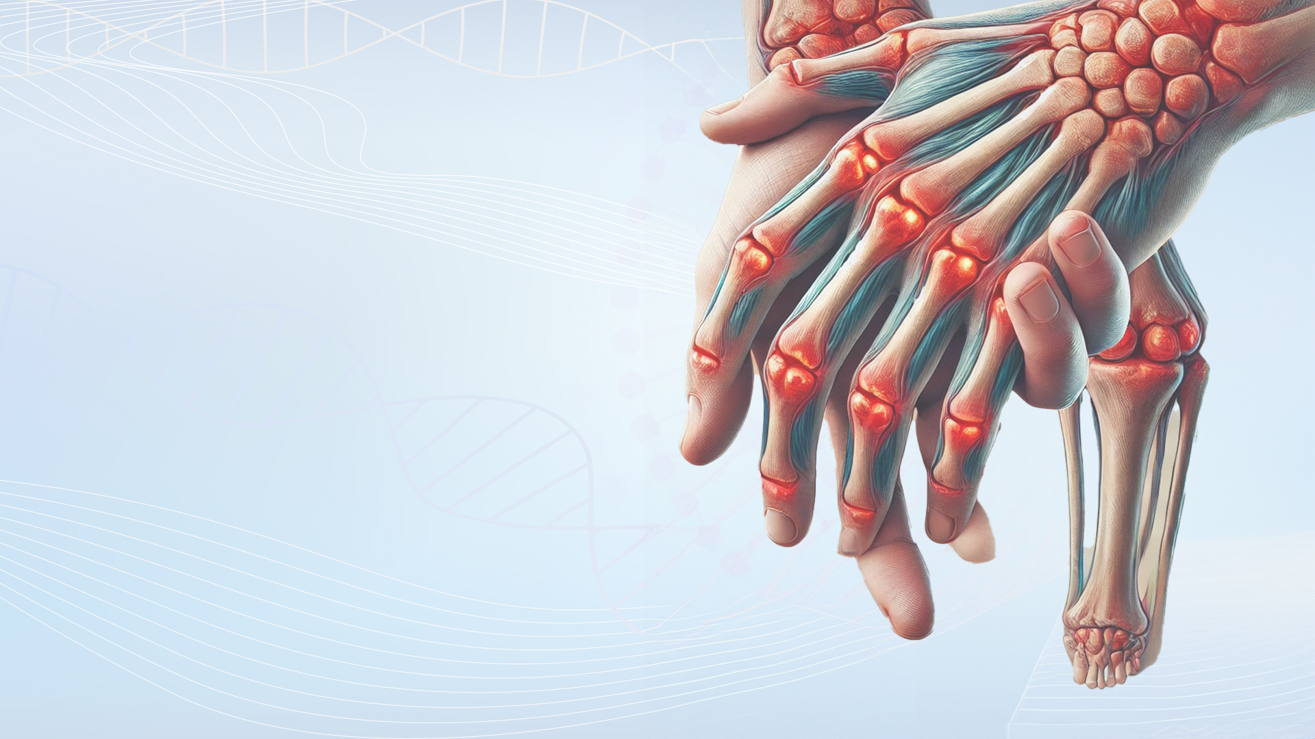 other/rheumatoid-arthritis.jpg other/rheumatoid-arthritis.jpg